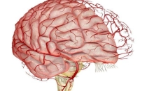 Укрепление сосудов головного мозга