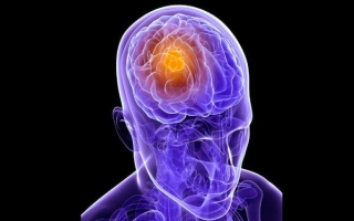 Сколько живут с метастазами в головном мозге при раке