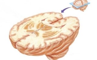 Базальные ганглии головного мозга