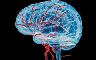 Гипоплазия артерий головного мозга