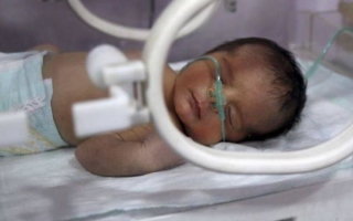 Последствия кислородного голодания мозга у новорожденных