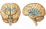 Асимметрия и увеличение боковых желудочков головного мозга