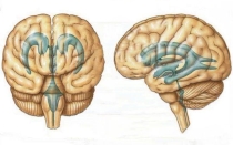 Асимметрия и увеличение боковых желудочков головного мозга