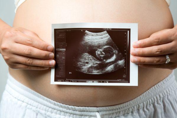 беременная со снимком узи